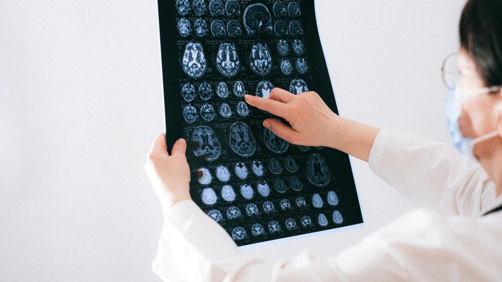Neurologie cu bilet de trimitere CAS: ce acte îți trebuie, cât este valabilă trimiterea și când ai nevoie de evaluare sau recuperare 2 Clinica medicală Renew Institute - Consult neurologie cu bilet de trimitere CAS