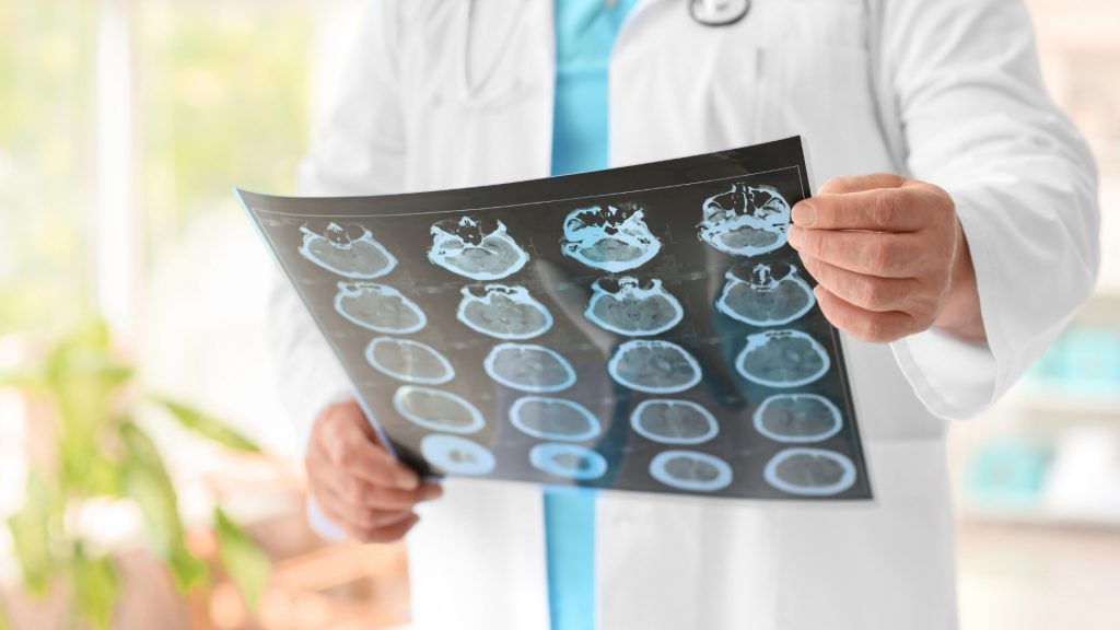 Consultație neurologie București (cu decontare prin CAS sau în regim privat): când mergi la medic pentru migrene, dureri de cap și tensiune cervicală 2 Clinica medicală Renew Institute de Neurologie cu bilet de trimitere decontat prin CAS